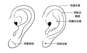 面相看耳朵_面相在线分析耳朵上的痣都代表了什么